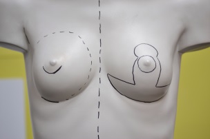 aumento-de-pecho-y-lipoescutura