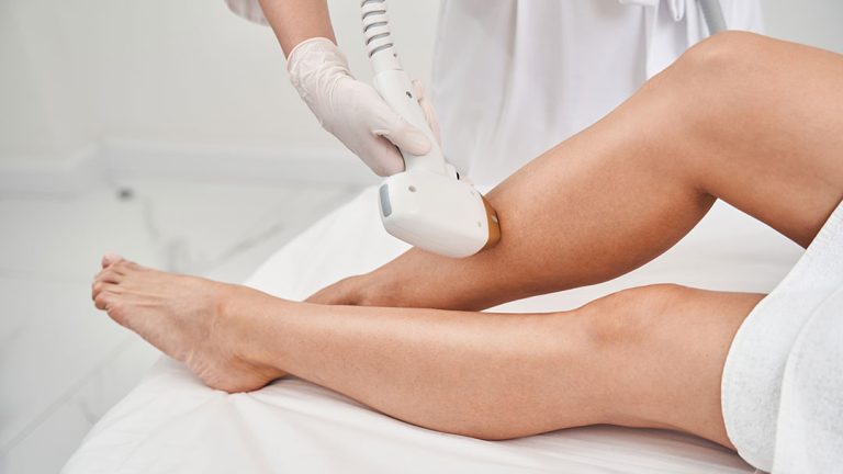 Depilación láser en piernas de mujer