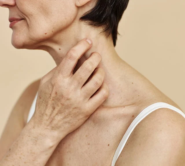 dermatologia-manchas-del-sol-1