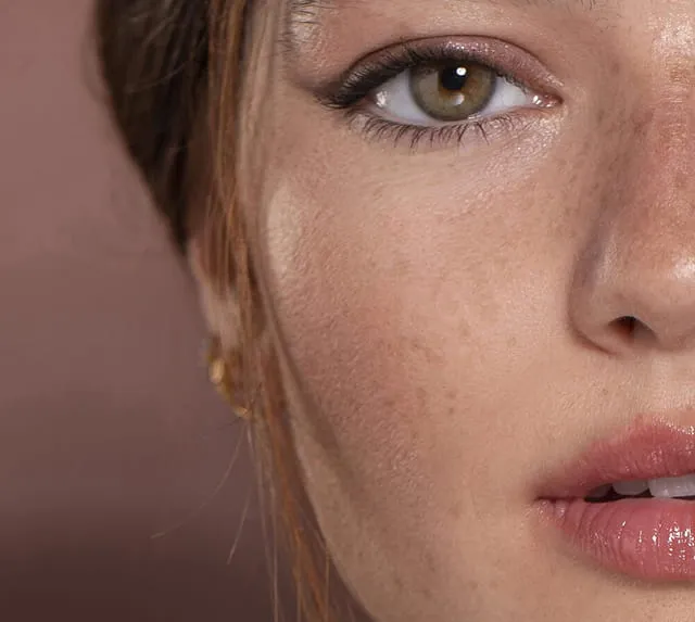 medicina-estetica-facial-cateyes-1